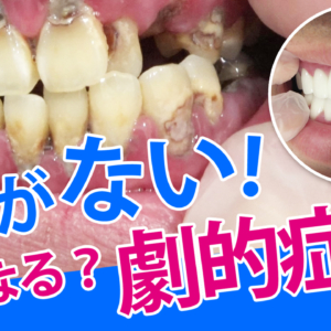 Youtube用サムネイル